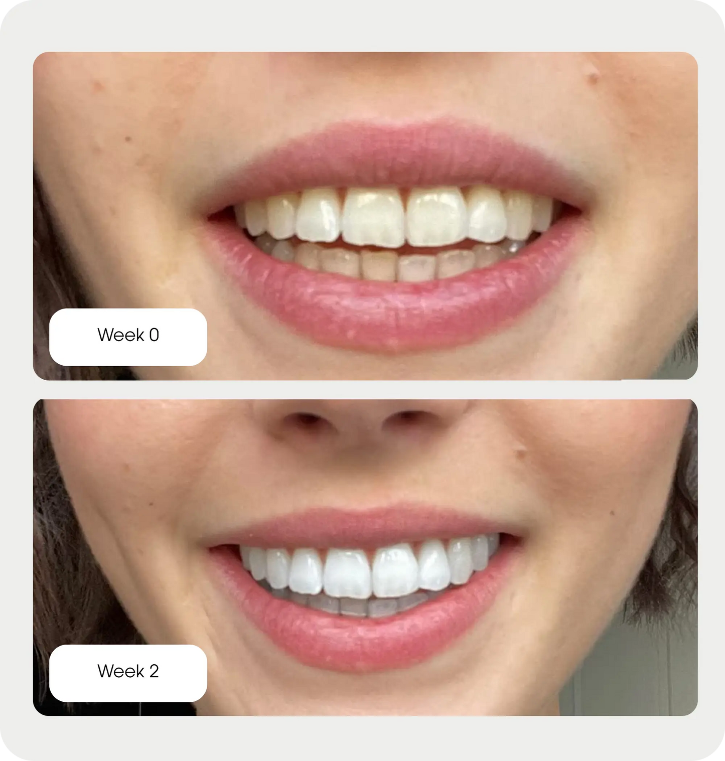 Purple Whitening Strips Ma boutique