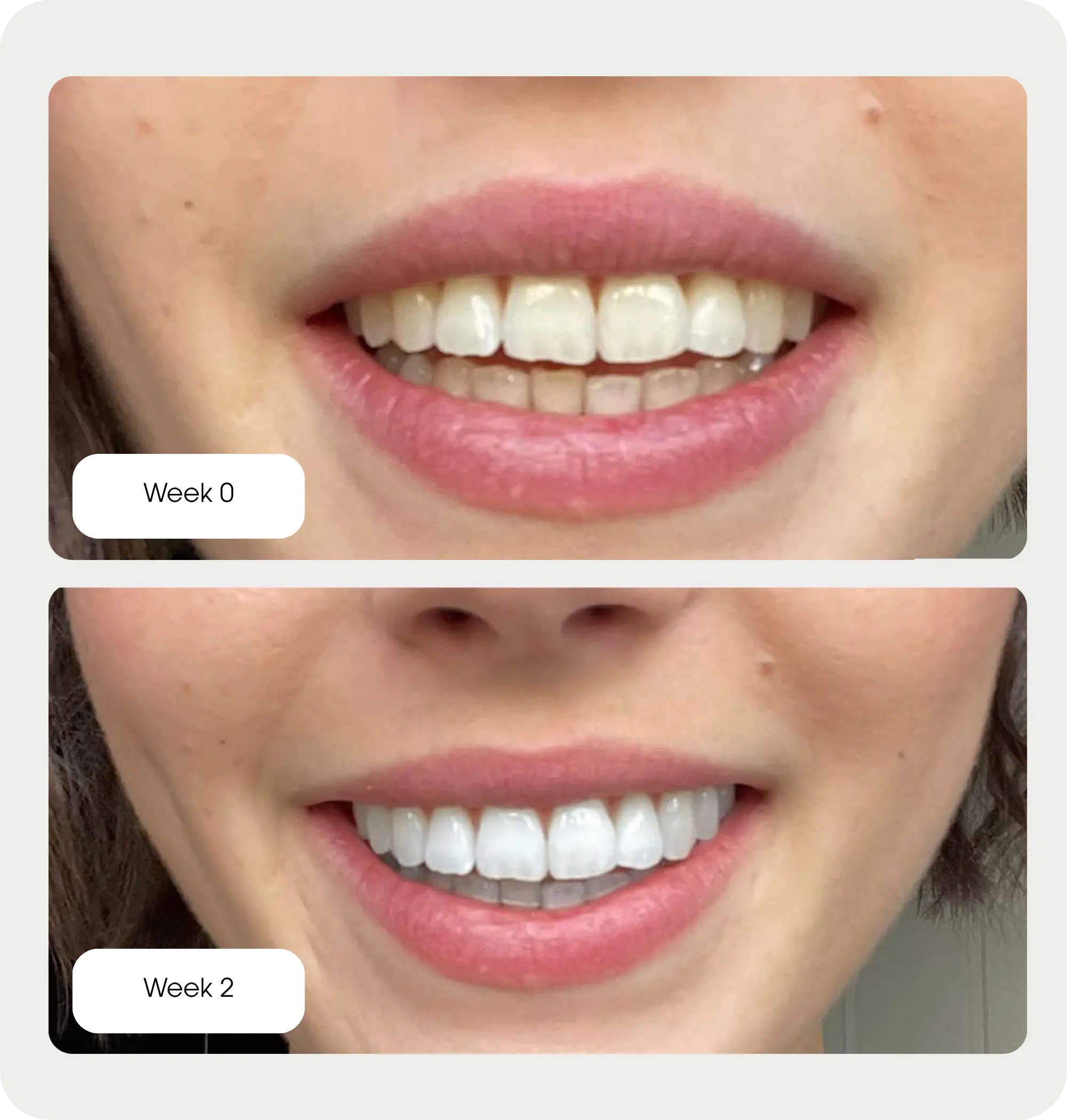 Purple Whitening Strips Ma boutique