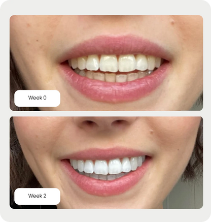 Purple Whitening Strips Ma boutique